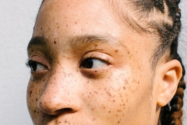 Close up portrait of girl with freckles